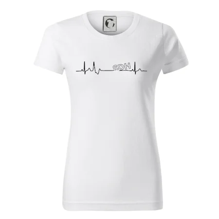 SDH EKG