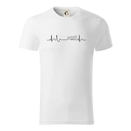 SDH EKG