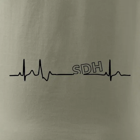 SDH EKG