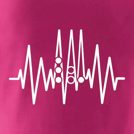 Backgammon  EKG