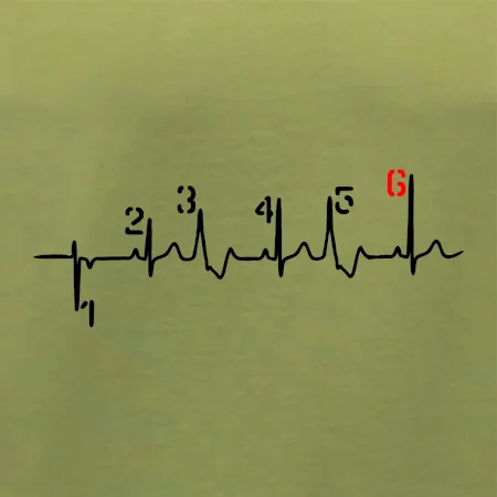 Moto EKG radenie