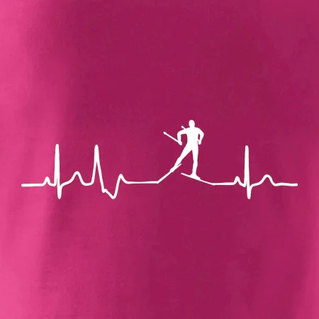 Ekg bežkár