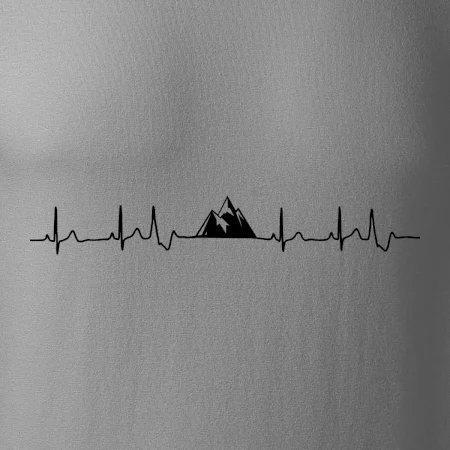 Hory EKG
