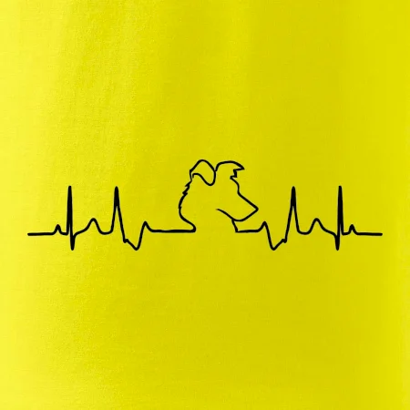 Borderská kólia EKG