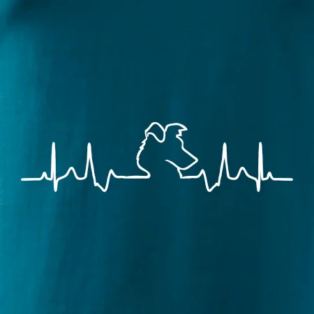 Borderská kólia EKG