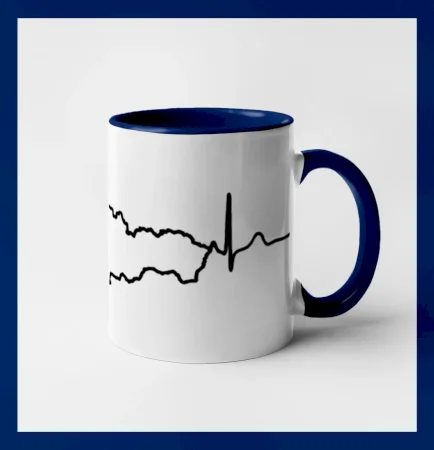 EKG Slovensko