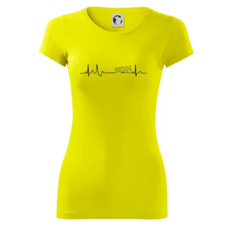 SDH EKG