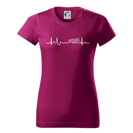 SDH EKG