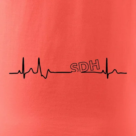 SDH EKG