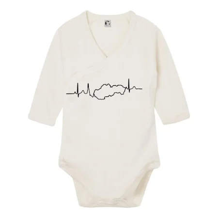 EKG Slovensko