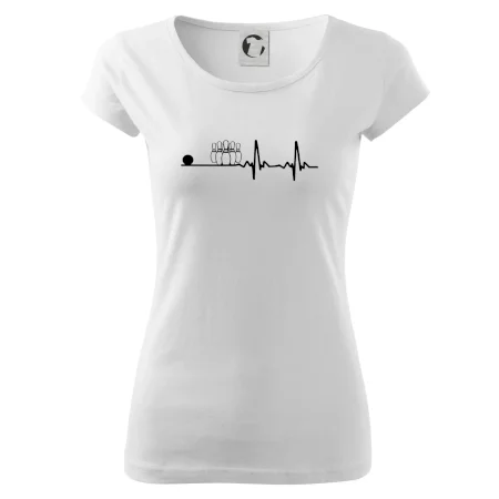 Kolky EKG
