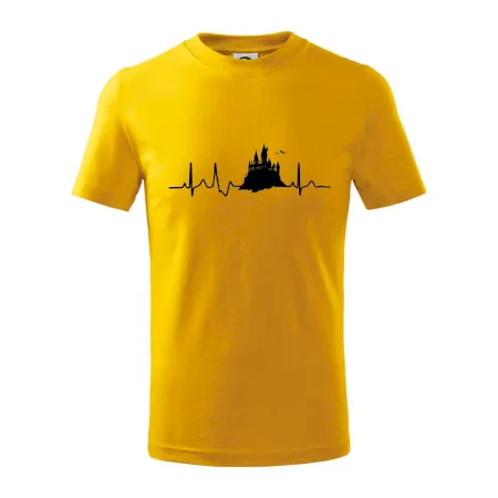 Harry -  EKG hrad
