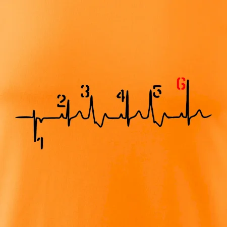 Moto EKG radenie