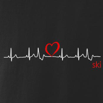 Moje srdce bije pre SKI Moje srdce bije pre SKI