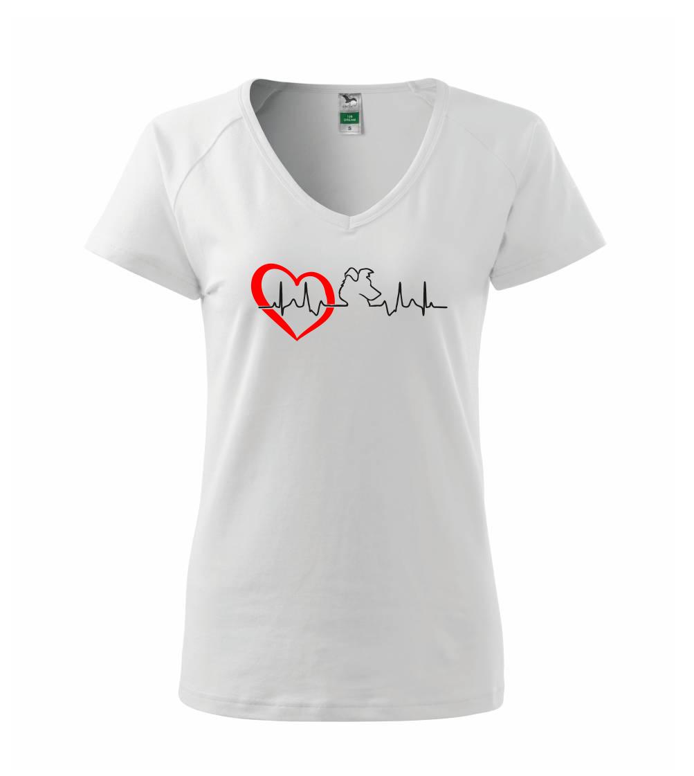 Borderská kólia EKG Borderská kólia EKG