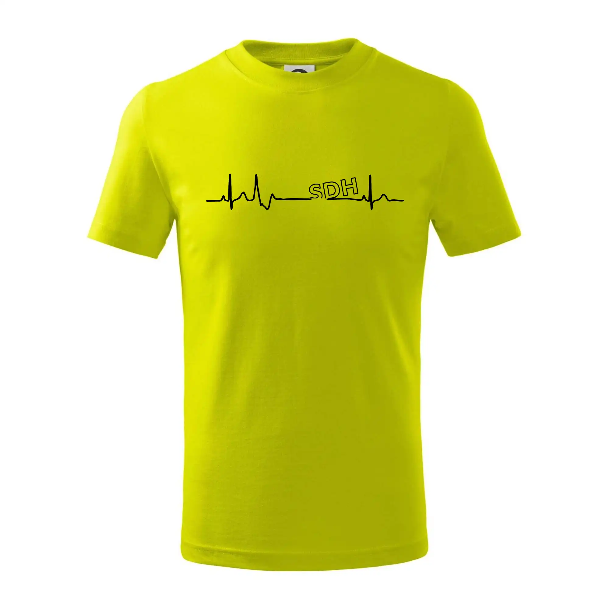 SDH EKG