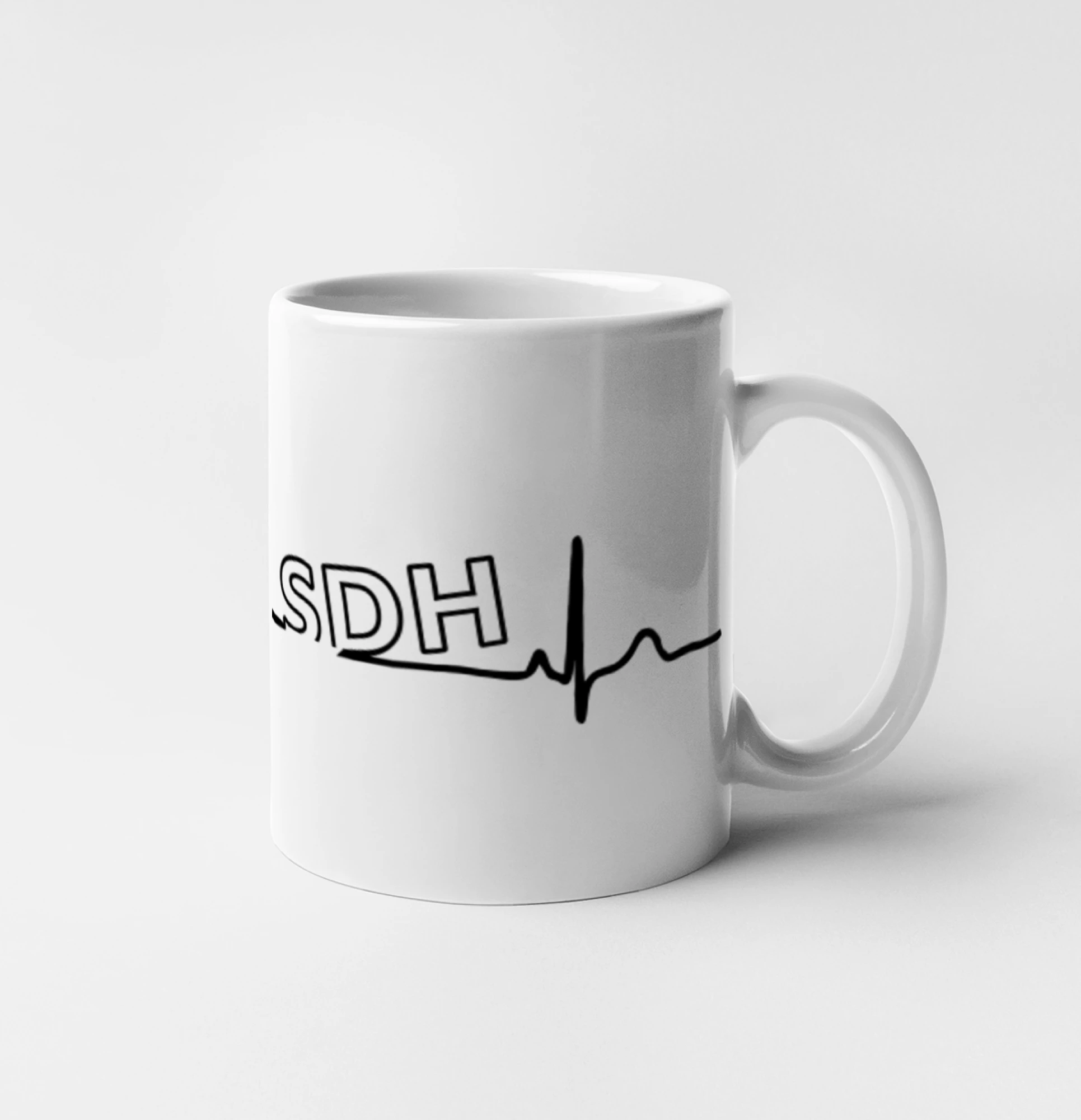 SDH EKG
