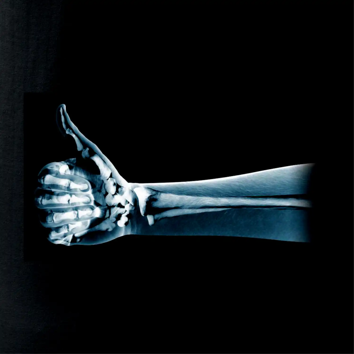 X-ray thumb up