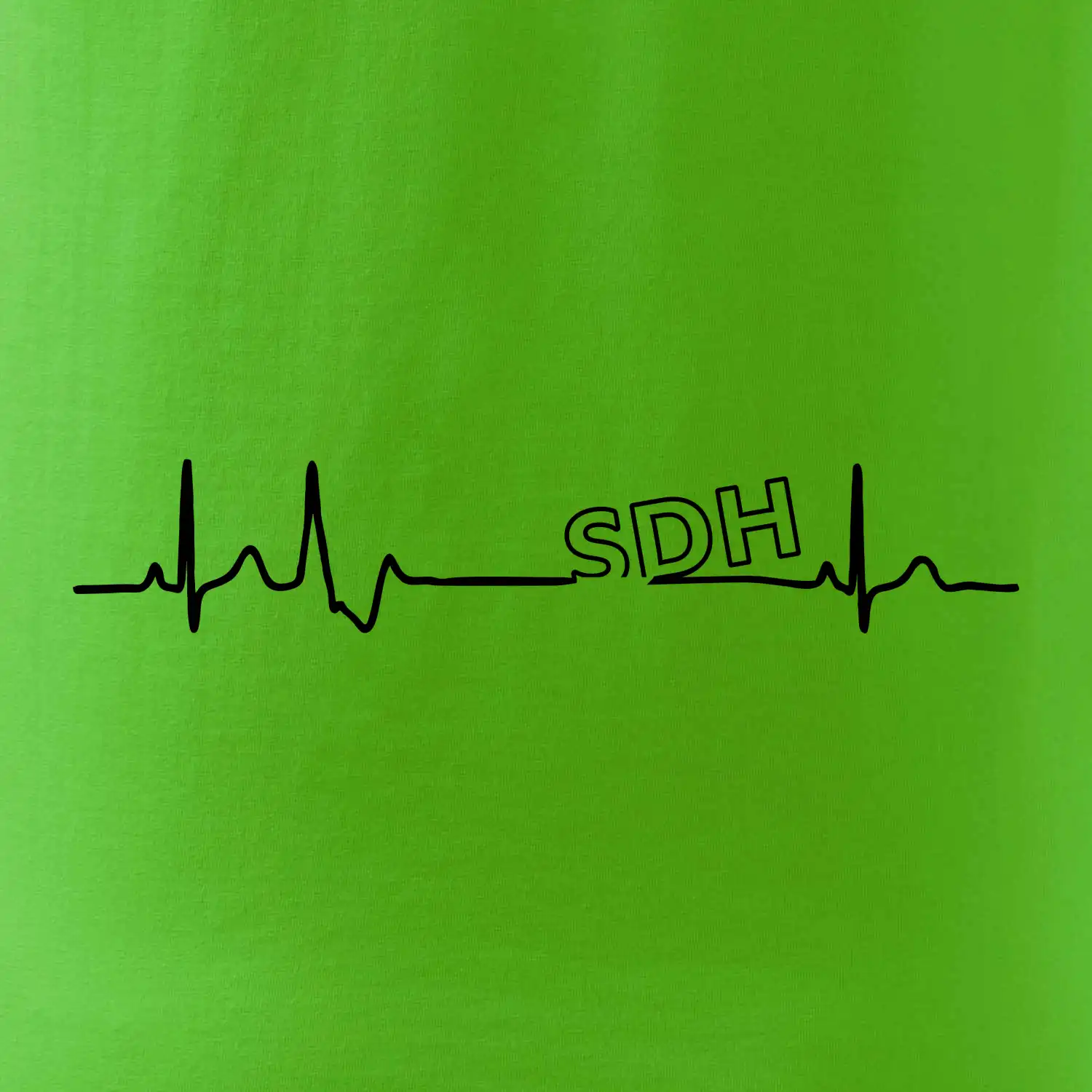 SDH EKG