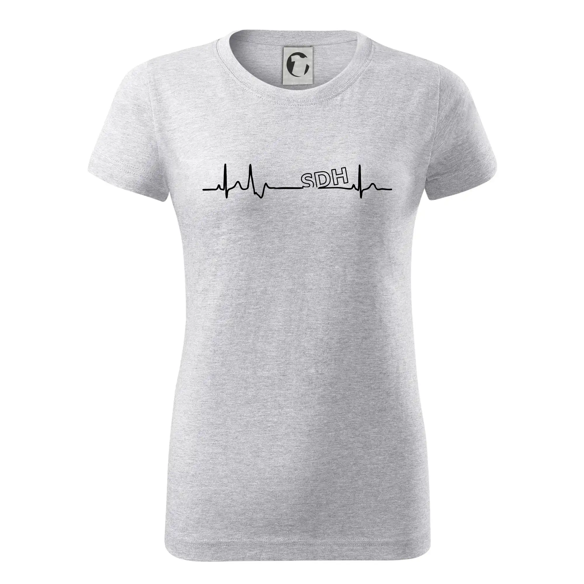 SDH EKG
