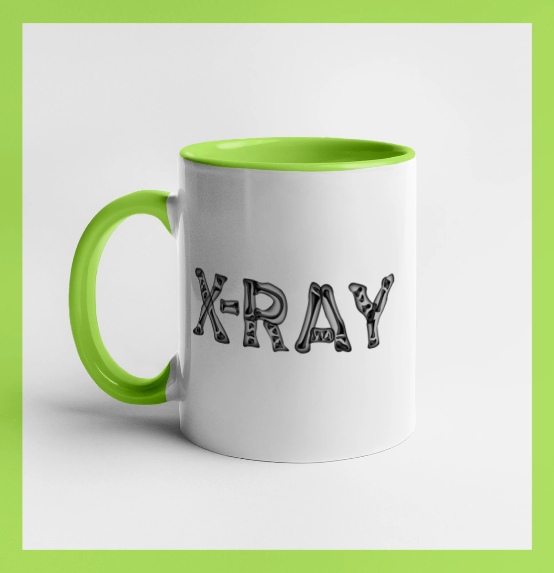 X-ray Lover