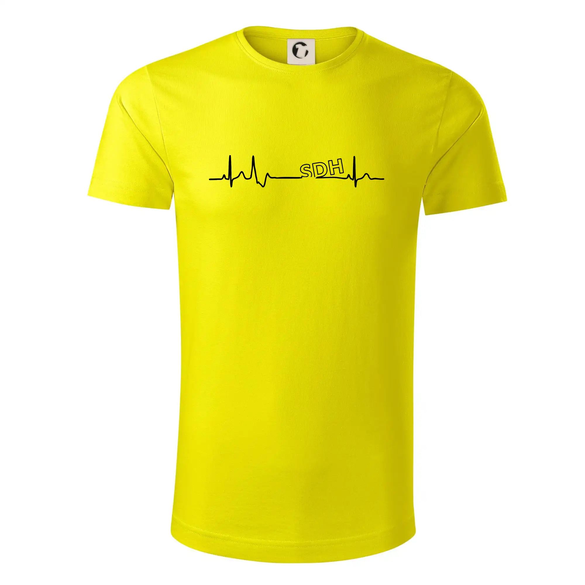 SDH EKG
