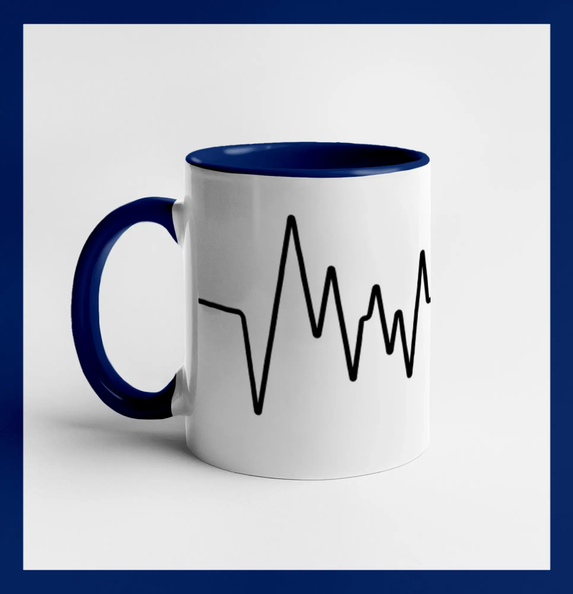Ekg samostatné